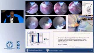 Special Lecture The Echternach Procession Towards Optimal Hydrocephalus Treatment [upl. by Asiilanna]