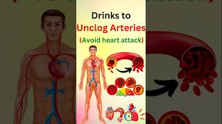 Drinks That CLEAR Your Arteries FAST [upl. by Beffrey]