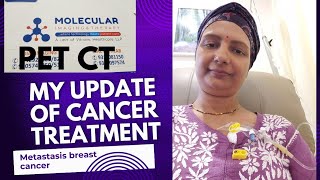 My cancer treatment update information breastcancer [upl. by Ylrak]