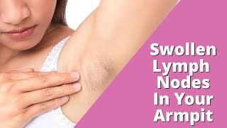 Swollen Lymph Nodes In Armpit  Lumps in Armpit [upl. by Ardelle212]