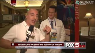 How Doctors Treat Hair Loss Without Surgery  FOX5 Las Vegas w Dr Alan Bauman [upl. by Ellenod]