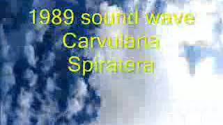 Rife Frequency  Carvularia Spiratera  Binaural Beats  1989 sound wave [upl. by Esertak]