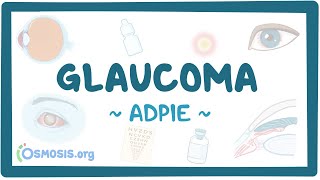 Glaucoma Nursing Process [upl. by Mlehliw]