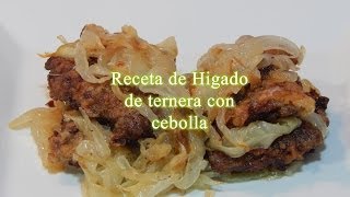 Receta fácil de higado rebozado con cebolla [upl. by Ariaz]