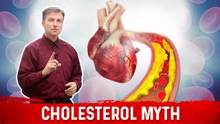 The Cholesterol Myths amp Facts [upl. by Nerrag]