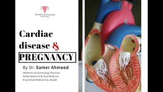 Cardiac disease amp pregnancy by Dr Samer Ahmeed [upl. by Chard]