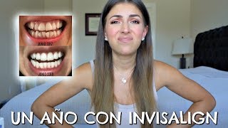 Un año con Invisalign  Mi experiencia  Costo  Fotos del Proceso 🙃 [upl. by Calloway]