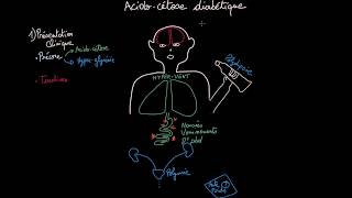 Acidocétose diabétique  Clinique  Diagnostique  Prise en Charge  Partie 2  Docteur Synapse [upl. by Llehcam]