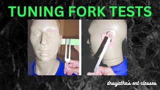 022 Tuning Fork Tests ear clinicalexamination [upl. by Ettenel903]