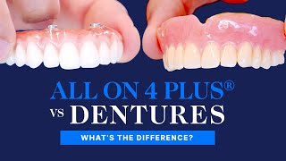 All On 4 Plus® vs Dentures  What Are The Differences [upl. by Tandi147]