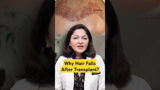 Hair Fall after hair transplant Hair Transplant hairtransplant hairloss hairimplant gurgaon [upl. by Wane]