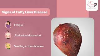 Fatty liver [upl. by Sacram580]