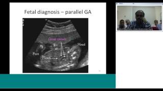 dTGA diagnosis and preoperative assessment by Dr Sivakumar [upl. by Lorraine]