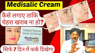 Medisalic cream Medisalic cream ke fayde  Medisalic Cream For Fairness  Safe or Not Review Hindi [upl. by Yeneffit860]