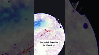 Malaria parasiteshotslikeshorts likeforlikesmedicallaboratorywatch sciencetrendingyoutuber [upl. by Stephan]