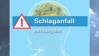 Schlafapnoe 8 Schlaganfall als Folge [upl. by Hofmann]