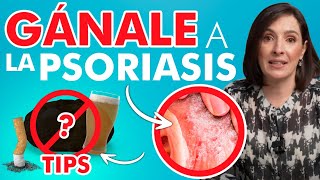 🔴 Si sientes esto tienes PSORIASIS Es CONTAGIOSA drapilarochoa Dermatologa [upl. by Schweiker]