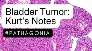 Bladder Tumors Kurt’s Notes pathagonia [upl. by Oah178]