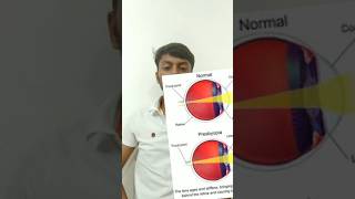 Presbyopia bio phys sciencefun experiment [upl. by Myron238]