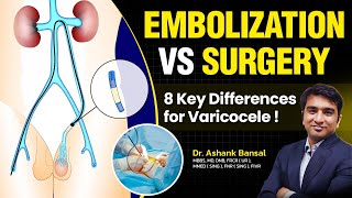 8 Differences Between Embolization and Surgery for Varicocele By Dr Ashank Bansal [upl. by Rayburn]