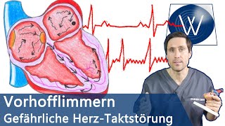 Vorhofflimmern Wenn Ihr Herz den Takt verliert Ursachen Therapie amp lebensgefährliche Folgen [upl. by Seve]