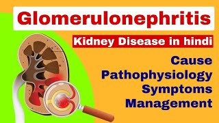 Glomerulonephritis  Nephritis in hindi  kidney disease  medical surgical nursing lecture [upl. by Kippar732]