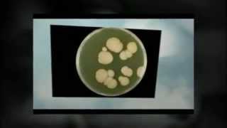 What causes yeast infections [upl. by Arimas]