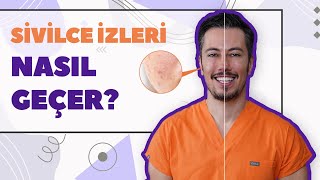 Sivilce İzleri Nasıl Geçer Akne İzleri Tedavisi [upl. by Loretta]