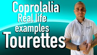 Coprolalia Part 2 Tourette’s real examples from my experience tics tourettes tourettesyndrome [upl. by Eelyme335]