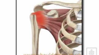 subacromial impingement aetiologymp4 [upl. by Kellyn416]