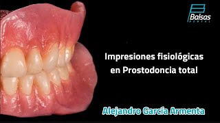 Impresiones Fisiológicas en Prostodoncia Total Alejandro García Armenta [upl. by Pence462]