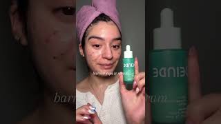 HOW TO LAYER SKINCARE ON ACNE PRONE SKIN 🧚🏼‍♀️🫧💅🏼🙂‍↕️acneskincareroutine acneskincare [upl. by Arytal256]