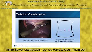 Small Bowel Obstruction  Do You Have to Open Them Up [upl. by Keavy670]