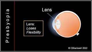 Presbyopia 1 Why Do We Need Reading Glasses [upl. by Acinomal392]