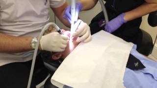 dentist injection drill and filling [upl. by Assirram75]