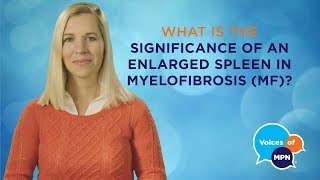 Why Is Spleen Size Important in Myelofibrosis [upl. by Dmitri]