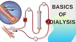 Basic concept of Dialysis Machine  Fresenius 4008S  Dialyzer amp Dialysate Function [upl. by Erlin98]