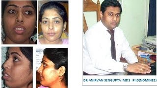 ARPITA SHEULI DASDR ANIRVAN SENGUPTAS PATIENTs INTERVIEW AFTER TREATMENT [upl. by Enelrac]