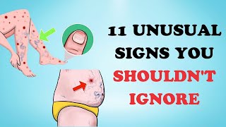 Unlocking the Secrets of Your Liver Health 11 Unusual Signs You Shouldnt Ignore  Healthy Care [upl. by Blanche]