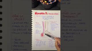 Bursitis retrocalcanea [upl. by Esma]