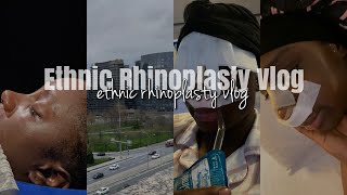 VLOG MY ETHNIC RHINOPLASTY IN TURKEY PT1  DETAILED RAW amp UNCUT [upl. by Nehgam]