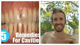 How To Heal Cavities Strengthen And Remineralize Teeth amp Bones Ligaments Joints Flesh amp Tendons [upl. by Lua150]