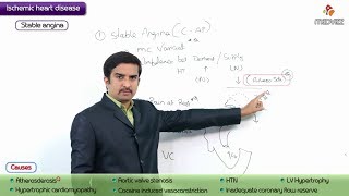 Pathology of Angina Pectoris  Stable Angina  USMLE Step 1 coronary artery disease [upl. by Tara]