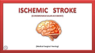 Stroke Part 1  Ischemic Stroke  Types  Causes  Pathophysiology  Treatment  The Nurses Station [upl. by Arria]