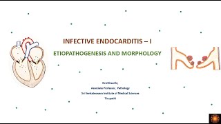 Infective endocarditis [upl. by Natsuj]