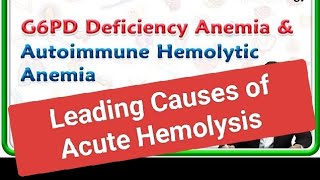 Leading Causes of Pediatric Acute Hemolysis [upl. by Ledba707]