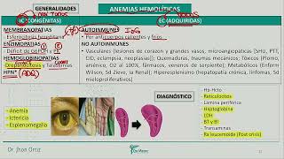 Hematología  Anemias hemoliticas esferocitosis hereditaria deficir de PK y G6PDH [upl. by Heddie]