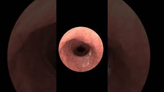 Exploring Your Insides with Gastrointestinal Endoscopy Animation 2024 [upl. by Land566]