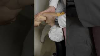 FRACTURA LUXACION DE CODO ELBOW FRACTURE DISLOCATION [upl. by Zeb]