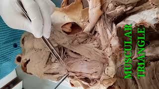 DISSECTION OF NECK PART1  BOUNDARIES OF ANTERIOR TRIANGLE OF NECK  BY DR MITESH DAVE [upl. by Tatia]